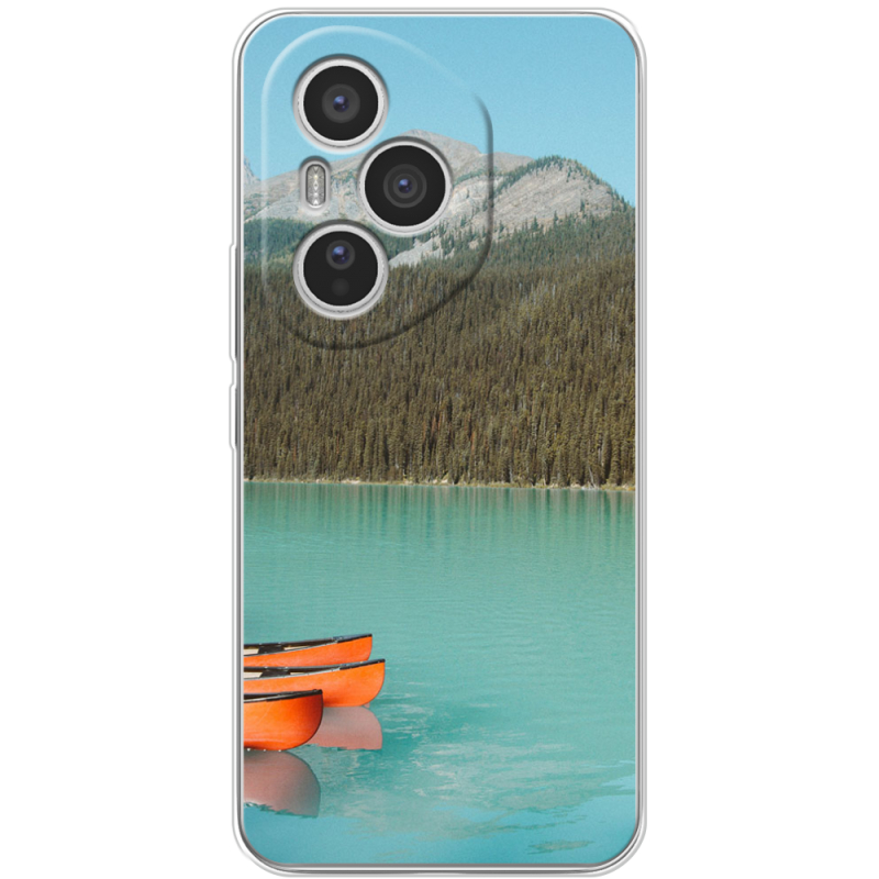 Чохол BoxFace Honor 400 Pro 