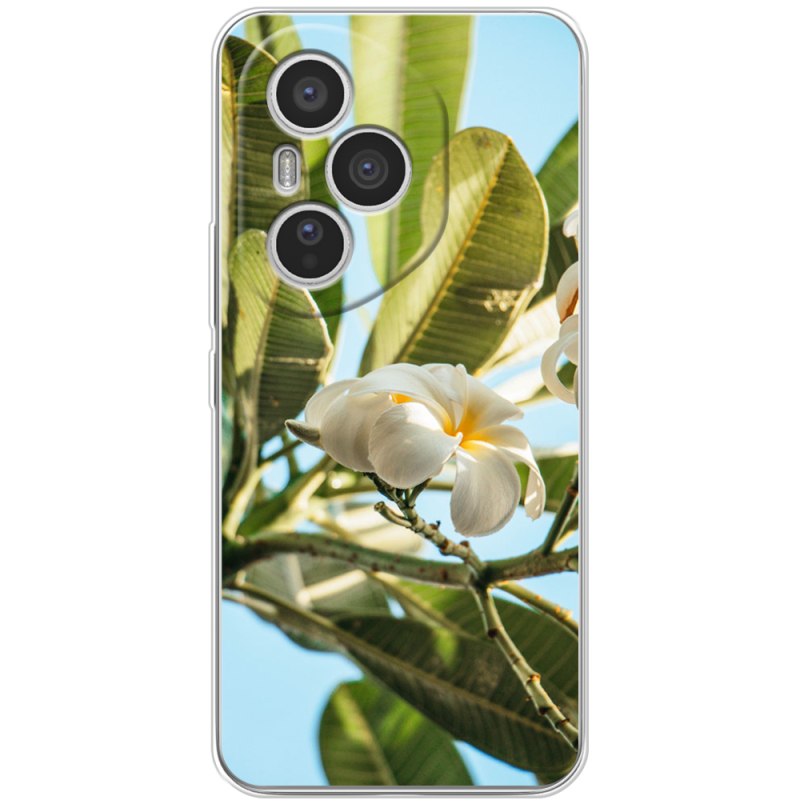 Чохол BoxFace Honor 400 Pro 