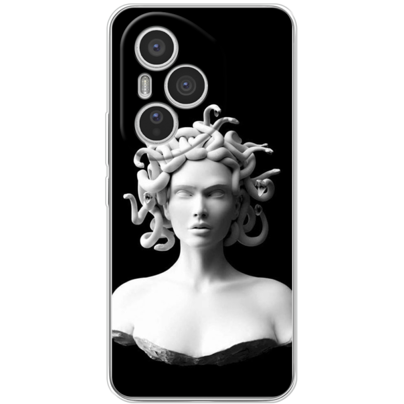 Чохол BoxFace Honor 400 Pro 