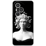 Чохол BoxFace Honor 400 Pro 