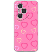 Чохол BoxFace Honor 400 Pro Sugar Hearts