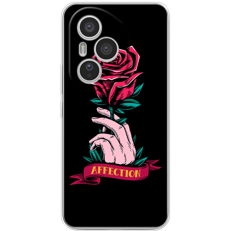 Чохол BoxFace Honor 400 Pro 