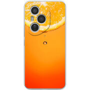 Чохол BoxFace Honor 400 Pro 