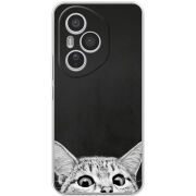 Чохол BoxFace Honor 400 Pro 