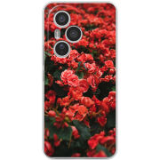 Чохол BoxFace Honor 400 Pro 