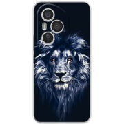 Чохол BoxFace Honor 400 Pro 