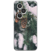 Чохол BoxFace Honor 400 Pro 