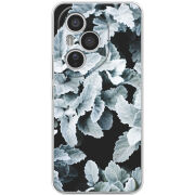 Чохол BoxFace Honor 400 Pro 