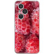 Чохол BoxFace Honor 400 Pro 