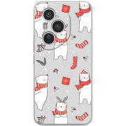 Чохол BoxFace Honor 400 Pro 