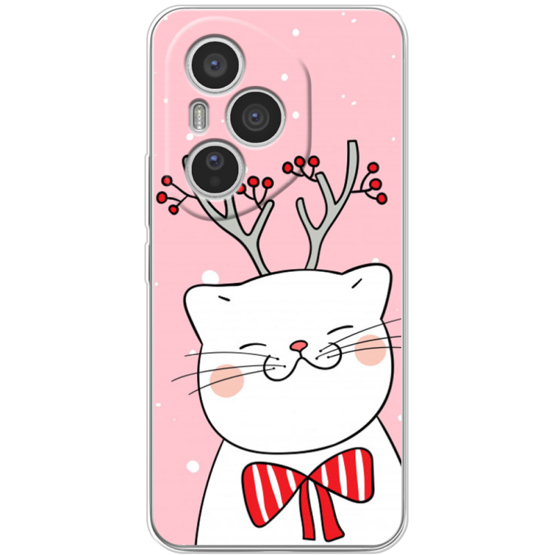 Чохол BoxFace Honor 400 Pro 