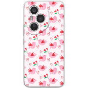 Чохол BoxFace Honor 400 Pro 