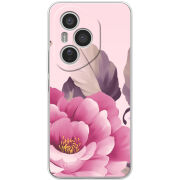 Чохол BoxFace Honor 400 Pro 