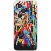 Чохол BoxFace Honor 400 Pro 