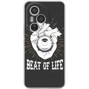 Чохол BoxFace Honor 400 Pro 