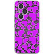 Чохол BoxFace Honor 400 Pro 