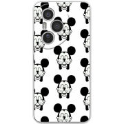 Чохол BoxFace Honor 400 Pro 