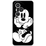 Чохол BoxFace Honor 400 Pro 