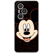 Чохол BoxFace Honor 400 Pro 