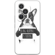 Чохол BoxFace Honor 400 Pro 