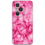 Чохол BoxFace Honor 400 Pro 