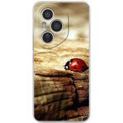 Чохол BoxFace Honor 400 Pro 