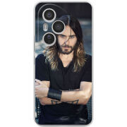 Чохол BoxFace Honor 400 Pro 