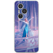 Чохол BoxFace Honor 400 Pro 