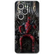 Чохол BoxFace Honor 400 Pro 