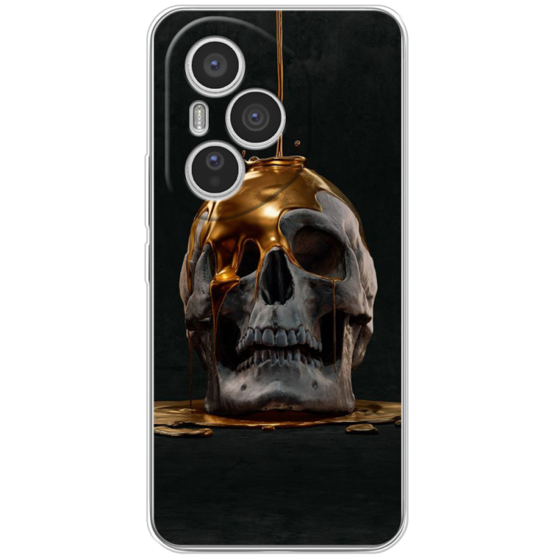 Чохол BoxFace Honor 400 Pro 