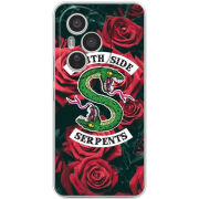 Чохол BoxFace Honor 400 Pro 