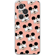 Чохол BoxFace Honor 400 Pro 