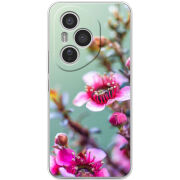 Чохол BoxFace Honor 400 Pro 