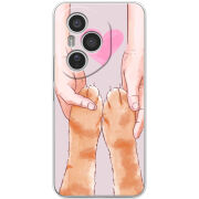 Чохол BoxFace Honor 400 Pro 