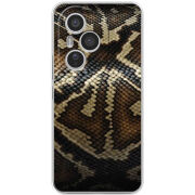 Чохол BoxFace Honor 400 Pro 