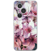 Чохол BoxFace Honor 400 Pro 