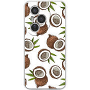 Чохол BoxFace Honor 400 Pro Coconut