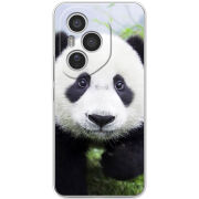 Чохол BoxFace Honor 400 Pro 