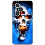 Чохол BoxFace Honor 400 Pro 