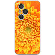 Чохол BoxFace Honor 400 Pro 