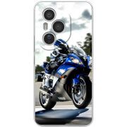 Чохол BoxFace Honor 400 Pro 