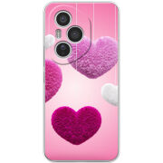 Чохол BoxFace Honor 400 Pro 