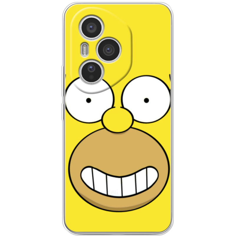 Чохол BoxFace Honor 400 Pro 