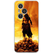 Чохол BoxFace Honor 400 Pro 