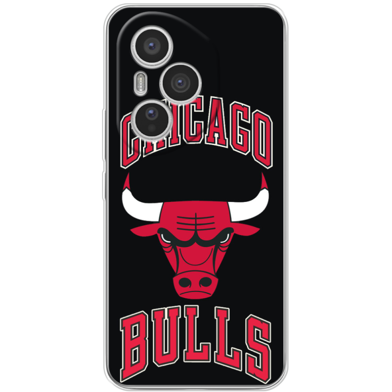 Чохол BoxFace Honor 400 Pro 