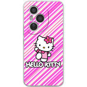 Чохол BoxFace Honor 400 Pro 