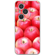 Чохол BoxFace Honor 400 Pro 