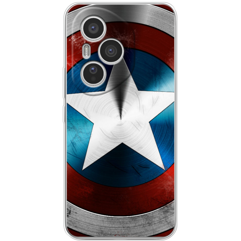 Чохол BoxFace Honor 400 Pro 