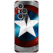 Чохол BoxFace Honor 400 Pro 