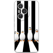 Чохол BoxFace Honor 400 Pro 